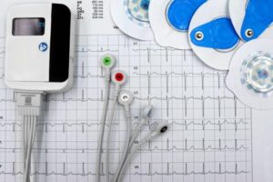 Wearable ECG Monitors: How They Work and What They Track