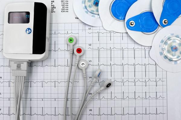 wearable ecg monitor